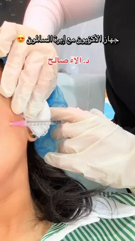 ابرة السالمون  @عيادات د. خالد الرحيمي- قرطبة  #عيادات  #عيادات_تجميل  #عيادات_الرياض  #ابره #ابرة #السالمون #عنبر #الاكزيون #اكزيون #نضاره #نضارة #نضارة_البشرة #نضارة_الوجه #مورفيوس #سكارليت #هبه #هبة #ترند #pypシ #explore #اكسبلوررر 