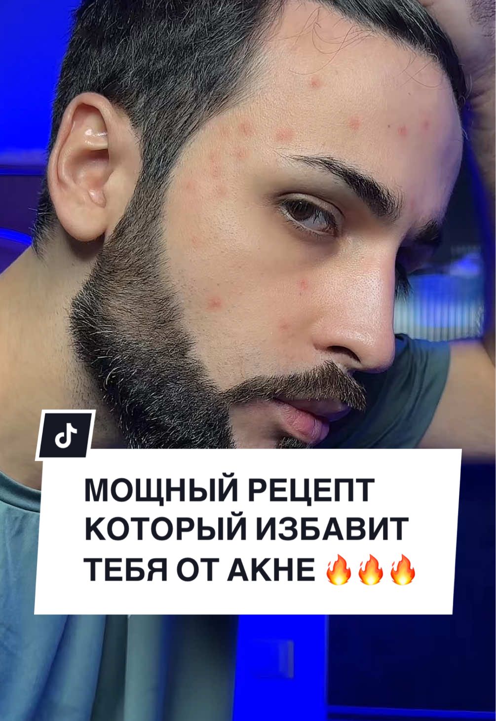 Передай дальше  вдруг кому-то тоже спасет лицо от акне 😉