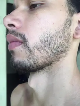 Resultado em 1 mês de uso  Do Barbudom  Comente  #barber #barbershop #barberia #barberlife #minoxidil #fyp #tratamentocapilar #barbudom #follow4follow #tratamentocapilarperfeito #foryou #like4like #fyyyyyyyyyyyyyyyyyyy #fyeシ #barbudo #barbudos #barbudom 