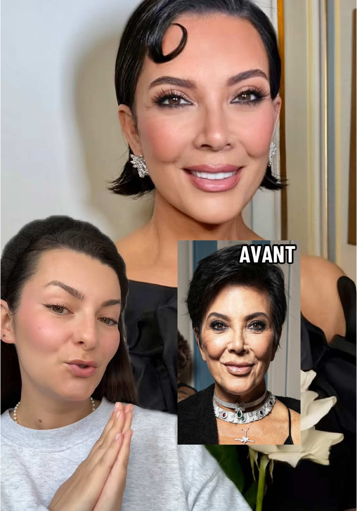 KRIS JENNER new face : plus jeune que jamais, elle dévoile un nouveau visage en 2025 #beauté #BeautyTok #krisjenner #kardashians 