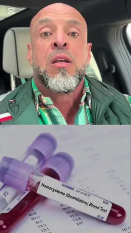 أرجوكم اعملوا هذا التحليل لو بتعانوا من توتر او ارق ؟ تفكير مفرط و اكتئاب و فقدان شغف؟ ارتفاع ضغط الدم و العرضه لأمراض القلب و الجلطات؟ مشاكل في الامعاء والقولون ؟ التهابات في كل جسمك؟ صعوبه في النوم؟ #توتر #anxiety #overthinking #القولون_العصبي #ضغط_الدم_المرتفع #تخسيس #mthfr #