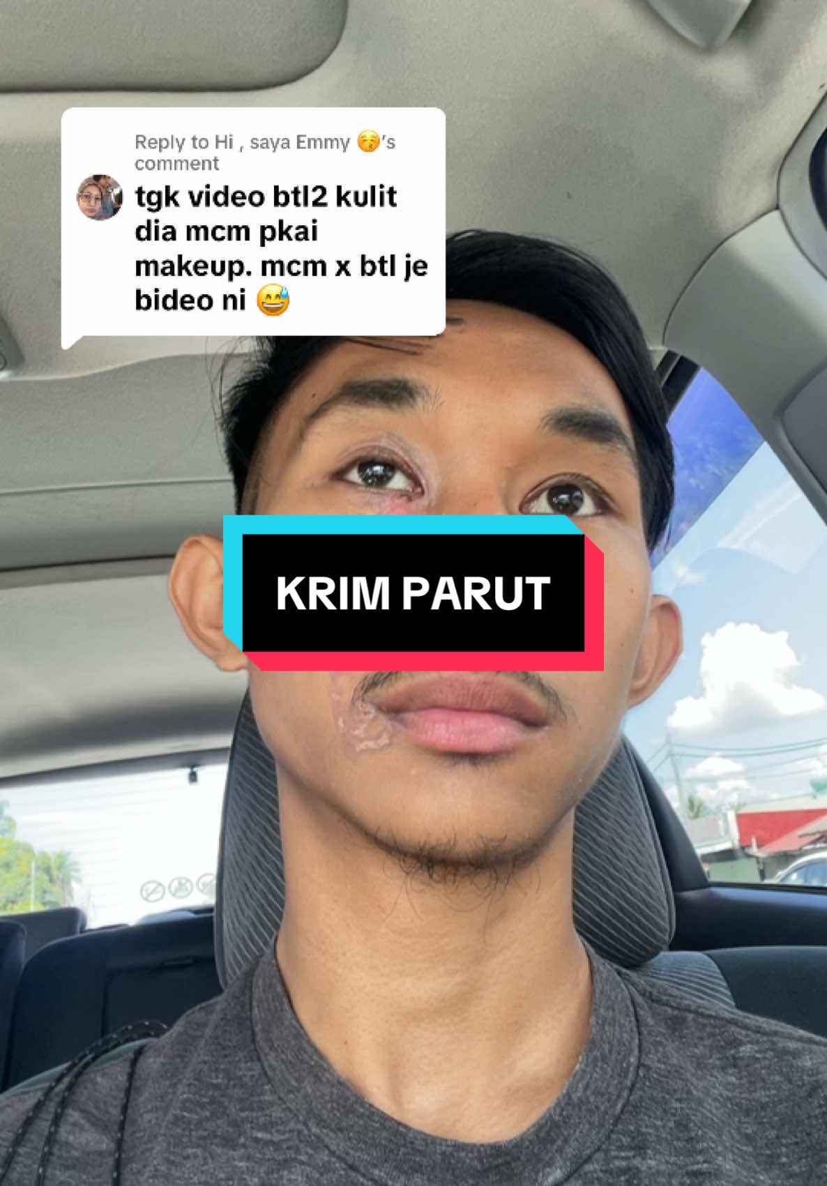 Replying to @Hi , saya Emmy 😚 #krimparut #parutmuka 