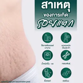 ทำความรู้จักสาเหตุของการเกิด รอยแตกลายบนร่างกาย ส่วนหนึ่ง อาจมาจากพฤติกรรมของเราเอง 🧐 👉🏻 กรรมพันธุ์ 👉🏻 ตั้งครรภ์ 👉🏻 ฮอร์โมน  👉🏻 น้ำหนักขึ้นๆ -ลงๆ  👉🏻 ยกของหนักเป็นประจำ 👉🏻 การใช้ยาสเตียรอยด์มายาวนาน เช่น ครีมทาผิวที่มีส่วนผสมของยาสเตียรอยด์  *ผลลัพธ์ขึ้นอยู่กับแต่ละบุคคล *ภาพพรีเซนเตอร์ใช้ในการโฆษณาเท่านั้น  💌 สอบถามนัดคิวปรึกษา วิเคราะห์ปัญหา ทักเลยค่ะ ยินดีให้คำปรึกษาทันที ไม่มีค่าใช้จ่าย 💚 ___________________________________ 📩 ติดต่อสอบถามเพิ่มเติมได้เลยนะคะ Tel : 065-464-5244 Line : @bondzclinic IG : bondz.clinic Tiktok : bondz.clinic Youtube : Bondz Clinic #BondzClinic #คลินิกความงามย่านศรีนครินทร์  #ฝ้า #กระ #หน้าใส #ฉีดฝ้า #facebright  #เหนียง #หน้าเรียว #แก้ม #แฟตแก้ม #รีแพร์ #มินิรีแพร์ #น้องสาวหลวม #กระชับช่องคลอด #bondzclinic #บอนซ์ด์คลินิก #คลินิกเสริมความงาม #รีวิวบิวตี้ #เทรนด์วันนี้ #คลินิกย่านสมุทรปราการ #คลินิกย่านอโศก