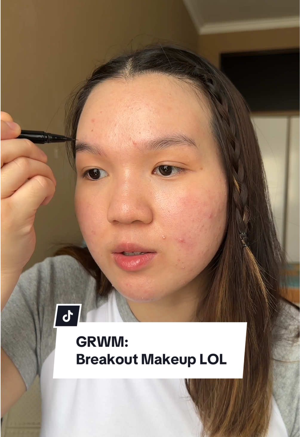 monthly breakout 🤭 #acnemakeup #grwm 
