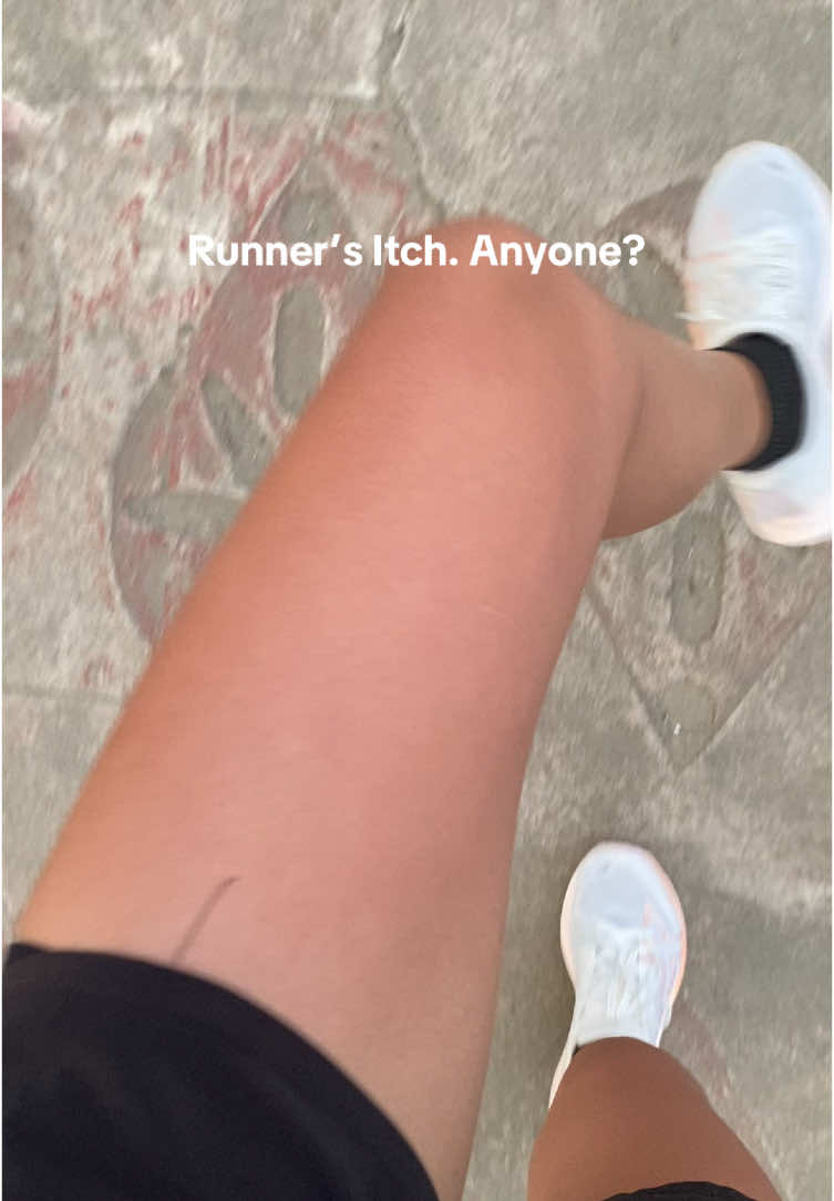Runner’s itch. Anyone? This happens every time I go a week without physical activity, except daily activities. Super kati ng legs ko dito and it even looked so red. Eventually, the sensation dies down once I’m into 30 minutes of the walk/run. #runningdiaries #walking #Fitness #runnersitch #beginnerrunner 