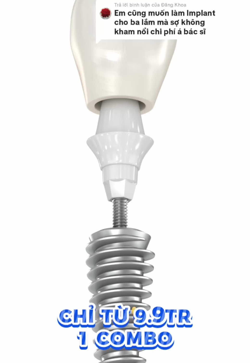 Ưu đãi 9.9 triệu/combo Implant – còn được tặng CT 3D miễn phí #nhakhoa #implant #cấy_ghép_implant #nucuoixinh 