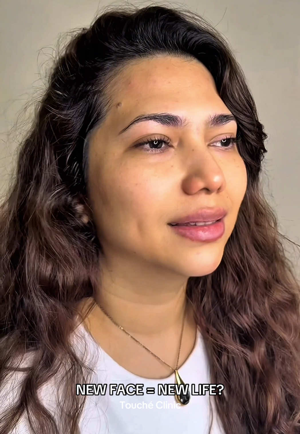 Non-Surgical FULL FACE