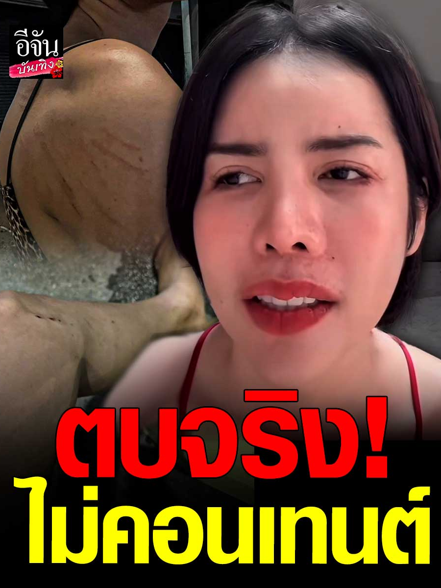 แรงเกิน! #นาราเครปกระเทย ถูกดักตบกลางดึกจริง! เจ็บจริง! ไม่ใช่คอนเทนต์ แต่ไม่ใส่ใจ ขอตั้งหน้าหาเงินใช้หนี้