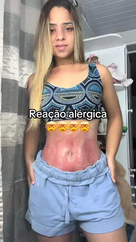 nada não, é só esse creme maravilhoso agindo na minha pele, ele está acabando com toda minha insegurança 🥰 #estrias #flacidez #celulite #redutordemedidas #creme #semfiltro #girls #fyy 