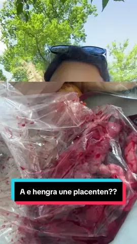 Po ju a e keni ngrene Placenten tuaj? #germany🇩🇪 #shqiptaretnegjermani🇦🇱🇩🇪 #düsseldorfgermany🇩🇪 #shqiptaretneperbote🇦🇱🌍 #mamatshqiptare🇦🇱 #placenta 