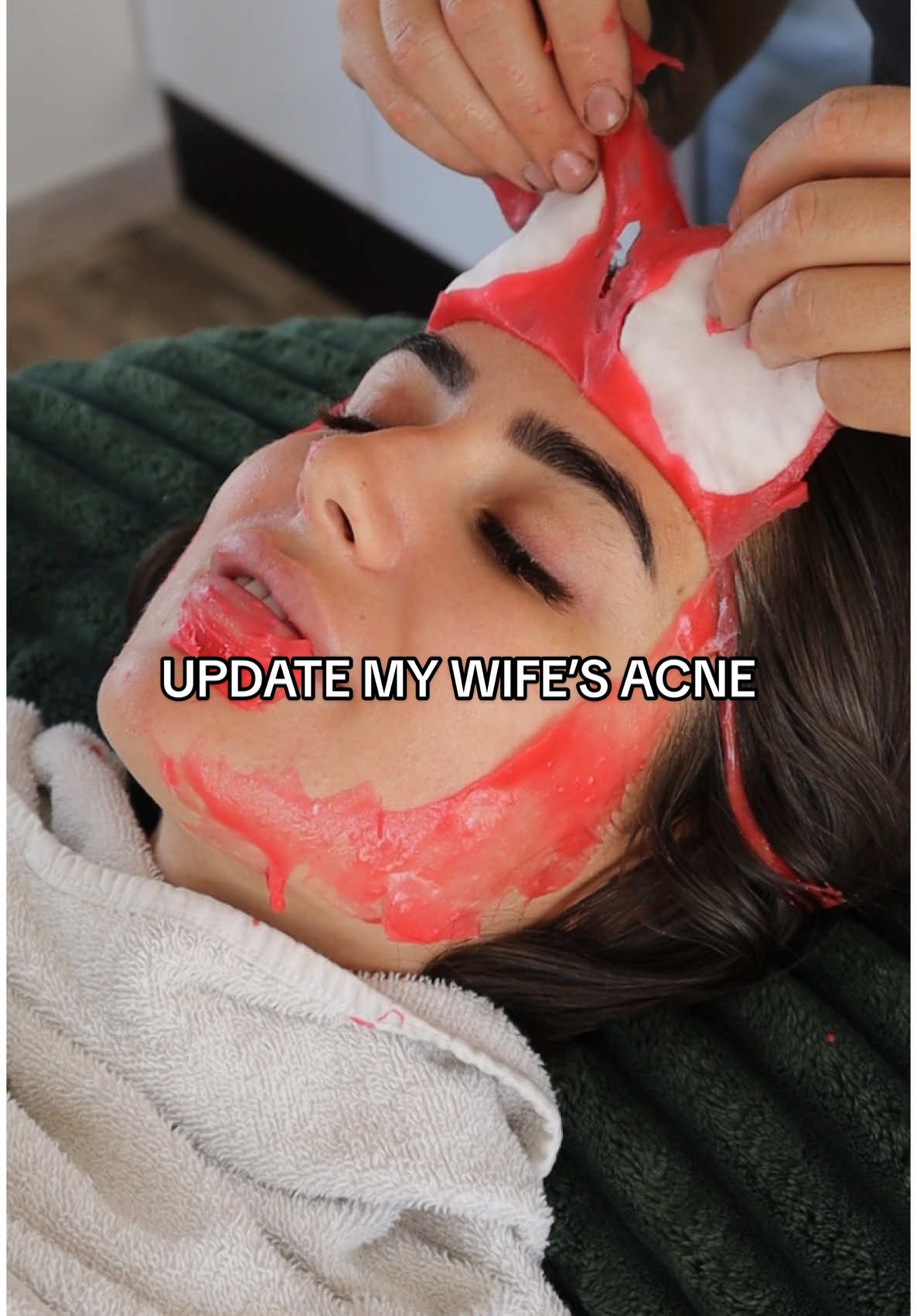 Update my wife´s acne !  My favorite Korean mask for acne-prone skin ➡️ KLAB : link in bio  #asmr #update #girlfriend #skincare #acneskincare 