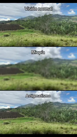 Visión Normal vs Miopía vs Astigmatismo 