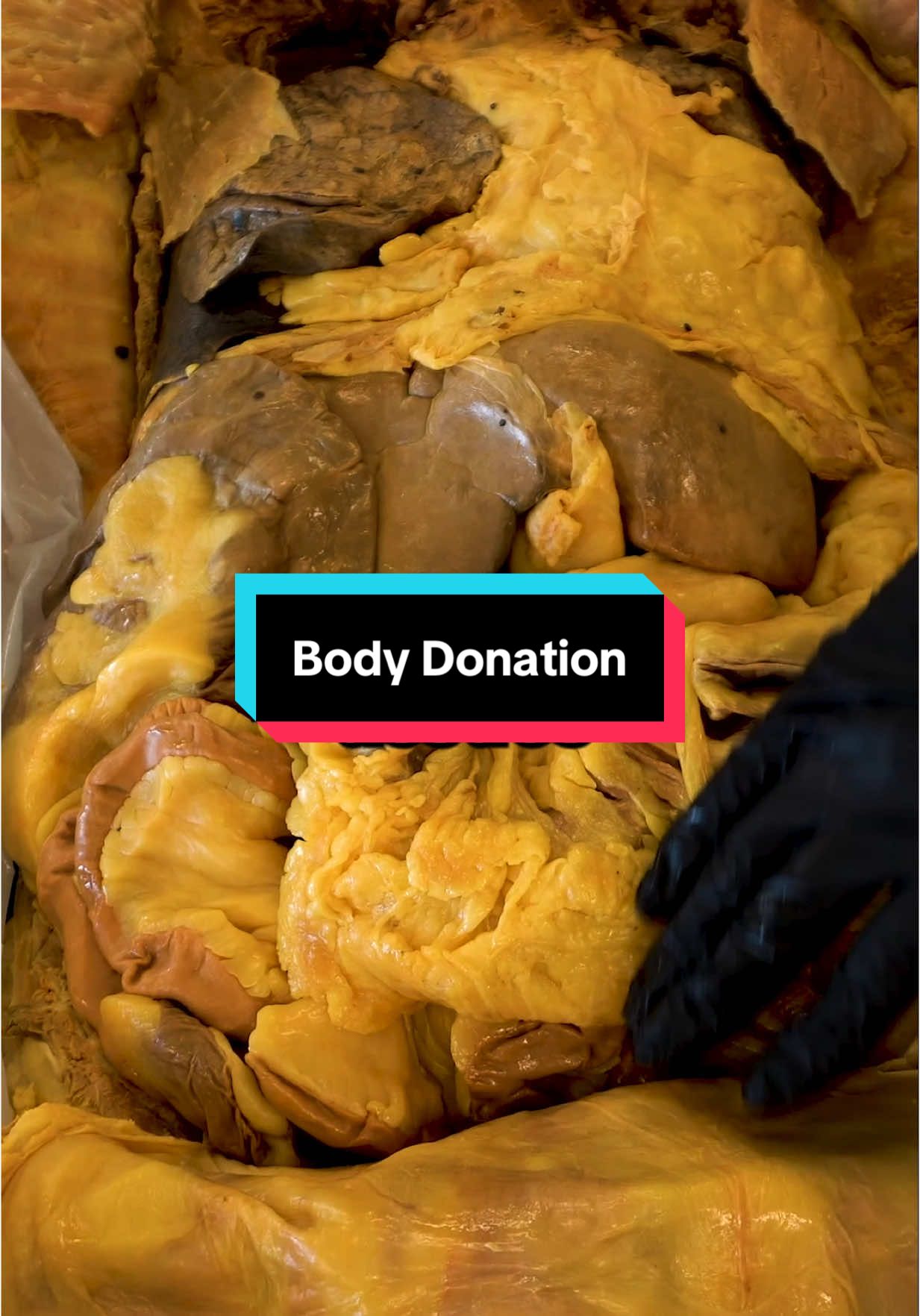 Body Donation Process - A few choices you make For more information on body donation - visit https://www.instituteofhumananatomy.com/blog/How%20to%20Donate%20Your%20Body%20to%20Science