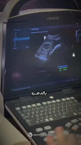 #capcut جاينا الصبي 💙🥺 #طفلي_فرحتي_الأولى💙  #حامل_للمرة_الاولي  #جنيني#ناطرتك_عيني #بالدهب_كتبي_بشارة_مدهبة😌💙 #قولي_لااحباب_جاينا_الصبي  #حامل_بصبي #💙🥺👼🏻🦋 #
