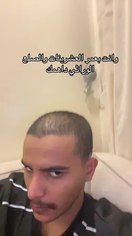 يخوان اي احد استخدم شي وفاده غير الاوفجين يعملني قبل يخلص شعري #تساقط_الشعر #زيت_تطويل_الشعر #صلع_وراثي #اصلع 