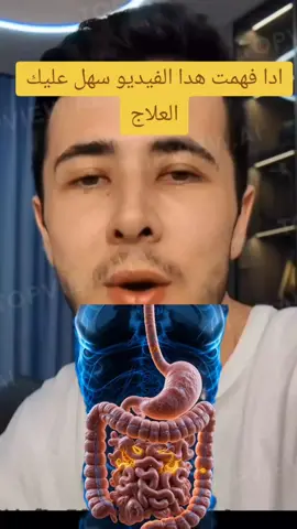 ادا فهمت هدا الفيديو سهل عليك العلاج #نصائح_مفيدة #صحة_الجهاز_الهضمي #نصائح_صحية #راحة_البطن #fyp #فرنسا🇨🇵_بلجيكا🇧🇪_المانيا🇩🇪_اسبانيا🇪🇸 #germany #france🇫🇷 #علاج_القولون #صحة_الجهاز_الهضمي #نصائح_مفيدة #العسل #من_أجل_صحة_أفضل #برنامج_صحي #الشعب_الصيني_ماله_حل😂😂 #gestrozen @معلومة طبية 💉 @معلومة طبية 💉 @معلومة طبية 💉 