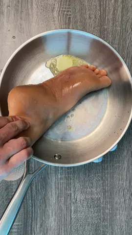 3rd degree burn? Try this… 