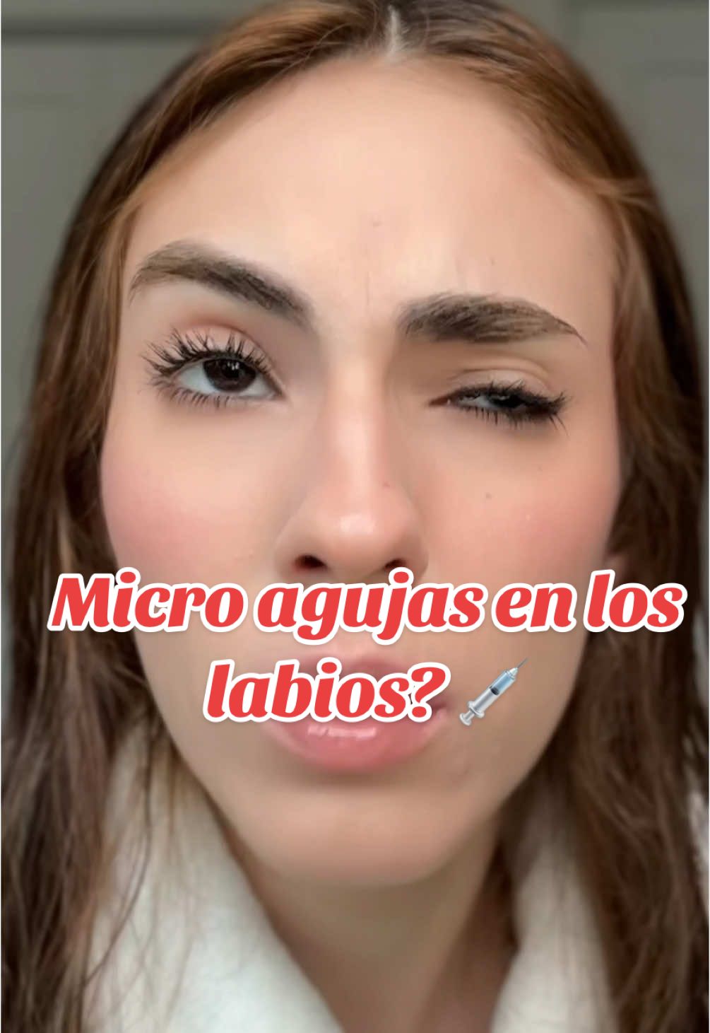 Casi termino en el hospital por un voluminizador de labios 😳?! #lipfiller #swelling #reedleshot #reedleshotlipplumper #lipflipresults #labiosgrandes #labiosbonitos #rellenolabios #rellenodelabios @VT Cosmetics US @vtcosmetics_latam 