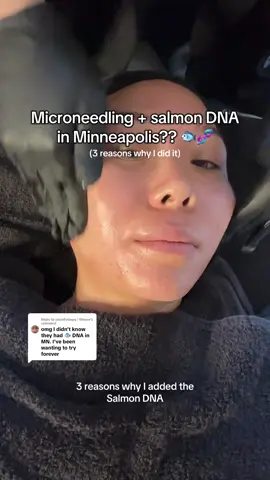 Replying to @uncmfydmpy | fitness I know the words “salmon DNA” sound intense… but it’s the BEST thing I’ve added to my microneedling routine 💉 Minneapolis girlies- @Ellena Aesthetics is where I got mine, and since you all were interested too, they gave me a referral code: CINDY so you can get $50 off your first visit! 🥰 #microneedling #salmondna #minneapolis #minneapolisskincare #minneapolismn #minneapolisminnesota 