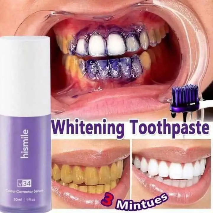 . . . #foryou #foryoupage #foryoupageofficiall #foryoupage❤️❤️ #foryoupagе #fyp #fy #fypage #fypシ゚ #reasonableprice #hismile #hismileteeth #whiteteeth #beauty #bangladesh🇧🇩 #dhaka #bdtiktokofficial #bd #ctg #tiktokbd #everyone 