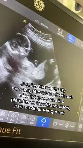 #mamaprimeriza #bebe #sexodelbebe 