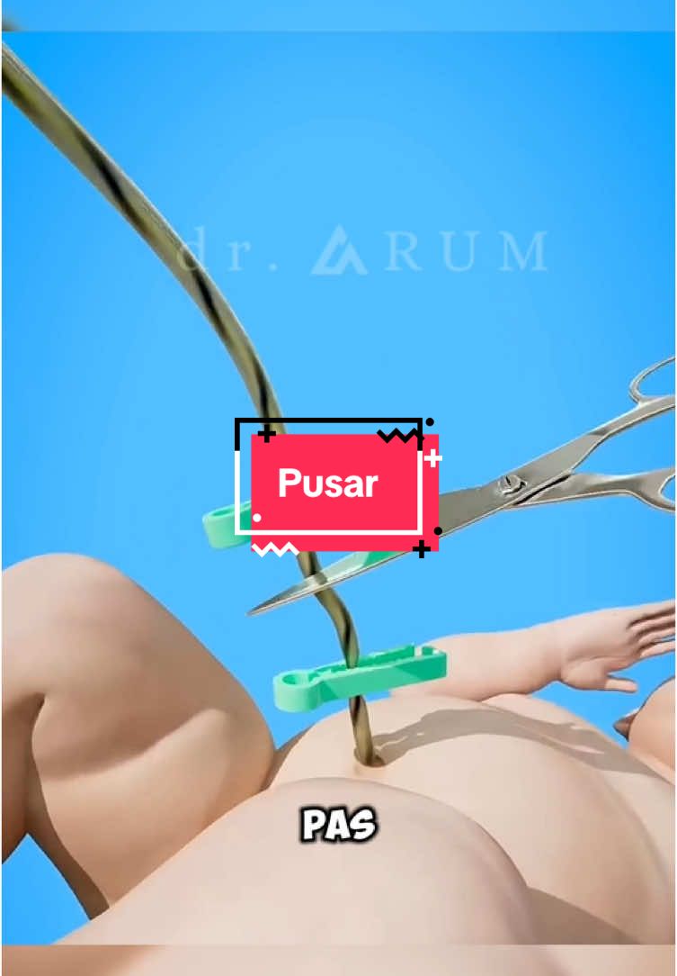 Apa yang Menyebabkan Pusar Outie?🤔 #FaktaUnik #OutieMystery #PusarAneh #MitosAtauFakta #SukaSuka62