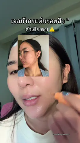 รอยสิวเยอะมากใช้ตัวนี้แต้ม#รอยสิว #เจลมังกรblahmbooh #เจลมังกรลดรอยสิว #เจลแต้มสิว #รีวิวบิวตี้ 
