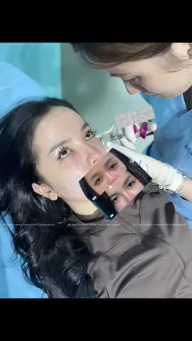 Dùng thuốc teoxane1 của thuỵ sĩ . Phù hợp với những bạn mắt thâm +  vì ngủ muộn thứ đêm , bạn có thể giảm được từ 60-80% tình trạng thâm mắt #phnomphenh #shihanukville #trending #hot #xuhuong #xuhuongtiktok 