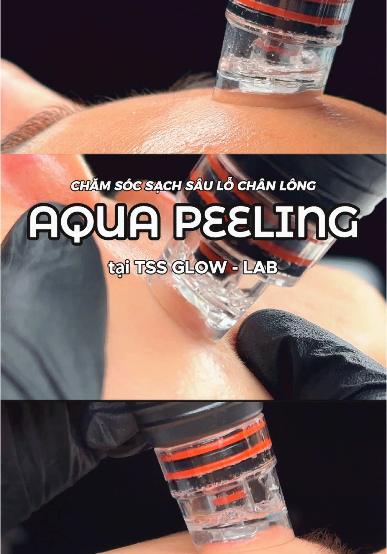 Một video đẹp sẽ hút được khách hàng yêu cái đẹp. Một buổi chăm sóc làm sạch lỗ chân lông tại TSS GLOW - LAB #spa #dieutrida #fyp #đào_tạo_nghề_spa #spachuyennghiep #xuhuong 