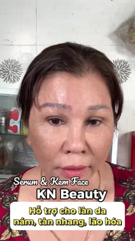 #sanphamchinhhang #kemnam #knbeauty #xuhuong 