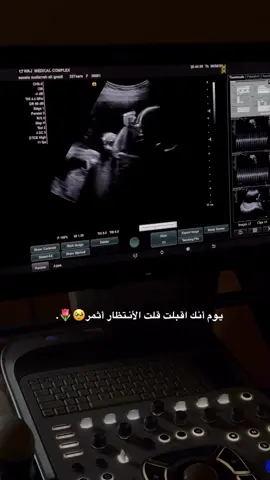 #بيبي #حمل #نساء #ولاده #انتظار #دكتوره #بيش #جازان #مالي_خلق_احط_هاشتاقات #الشعب_الصيني_ماله_حل😂😂 #اكسبلورexplore #tektok #cute #1millionaudition 