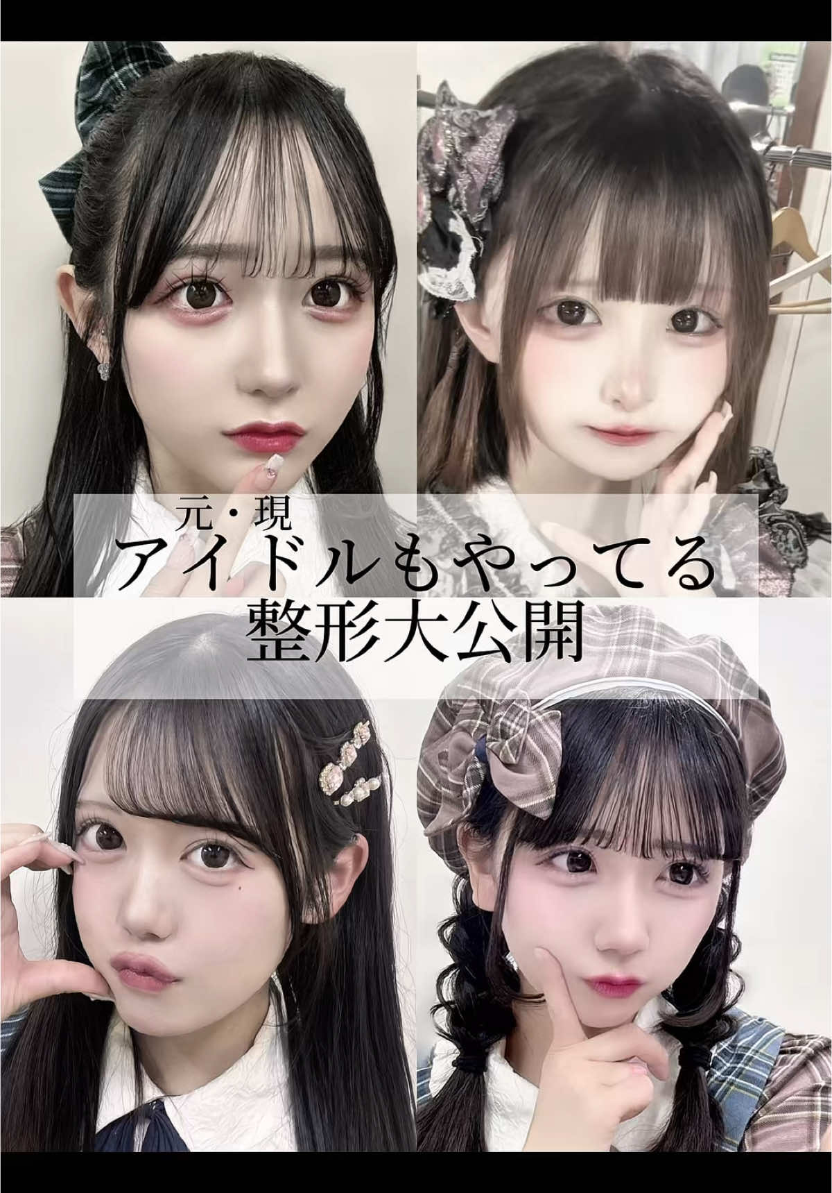 アイドルがやってる整形大公開㊙️ #整形 #二重整形 #アイドル #埋没 @saito_.chinatsu @もも @かれんれん 