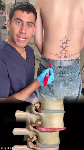 Todos los problemas de espalda, ¡ya no hay de qué preocuparse!#fyp #painrelief #clearzalpain #clearzal 