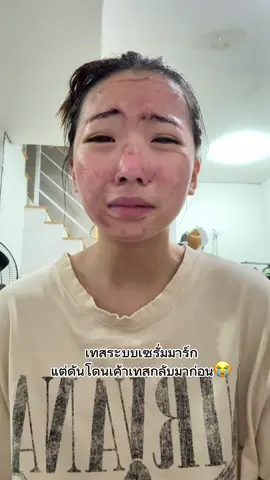 เริ่ดเกินคุณแม่ ##สิว#ผลัดเซลล์ผิวSkintificTH#fyp 