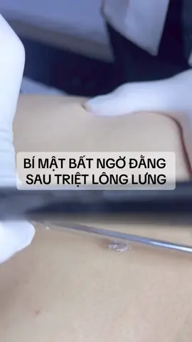 Có nên triệt lông lưng hay không❓ #congnghetrietlongdaulanh #lamdepmoingay❤❤ #trietlongcongnghecao #dadepkhongtivet #43danang #NQSPA #CapCut 