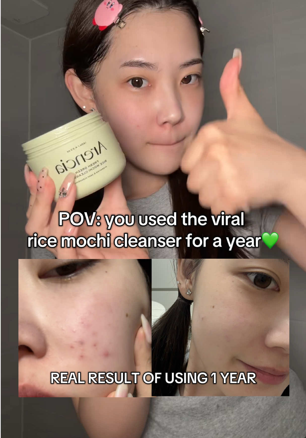 One of the top reason why my skin is looking so much better these days! Arencia rice mochi cleanser #arencia #ricemochicleanser #riceskincare #skinjourney #acneskin #mochicleanser 