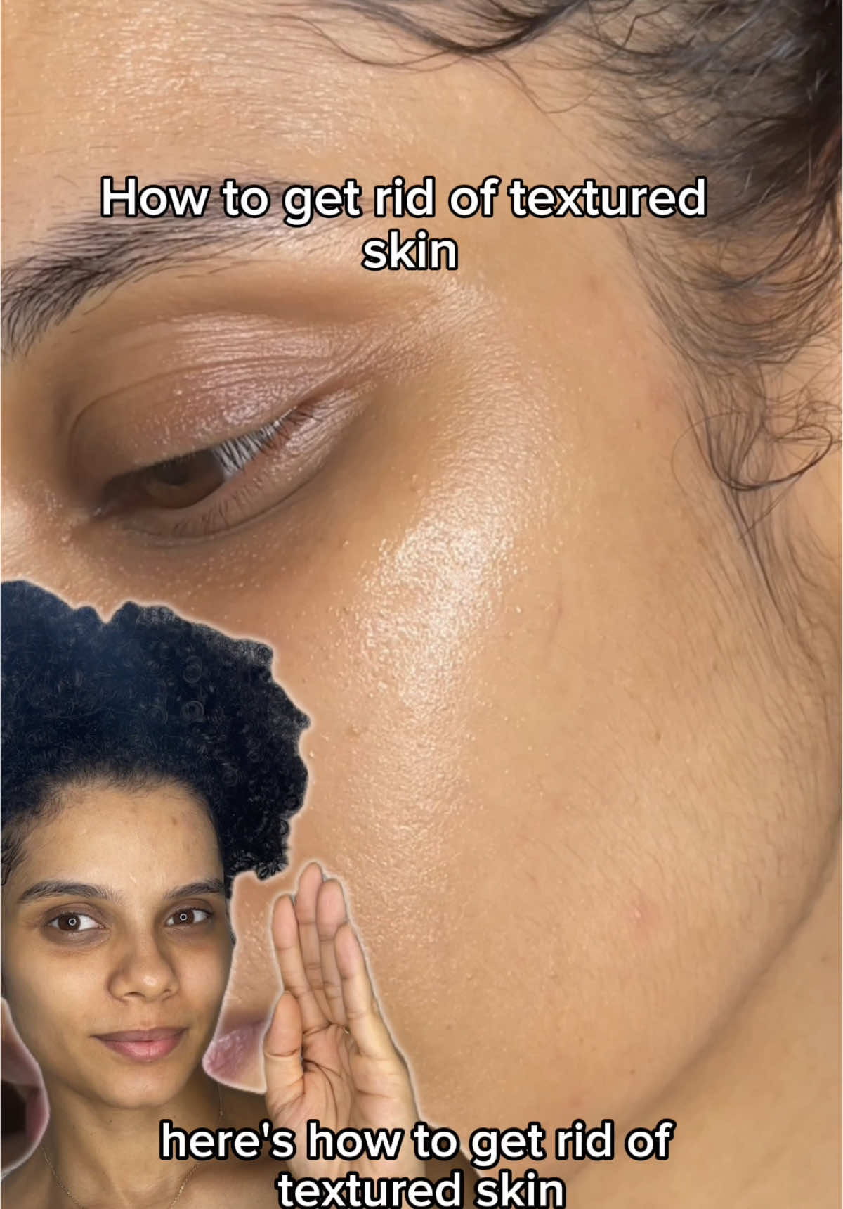 How to get rid of textured  skin?! ✨ @SAM’U  #samu #glassskin #o2toner #skintexture #riceyeasttoner #ricetoner #pores #poreserum #sebum #galactomyces #cloggedpores