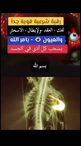 #رقية_شرعية_قوية_جدآ_لفك_ #العقد_والعيون👁_ولاسحار💀_بأمرالله☝️