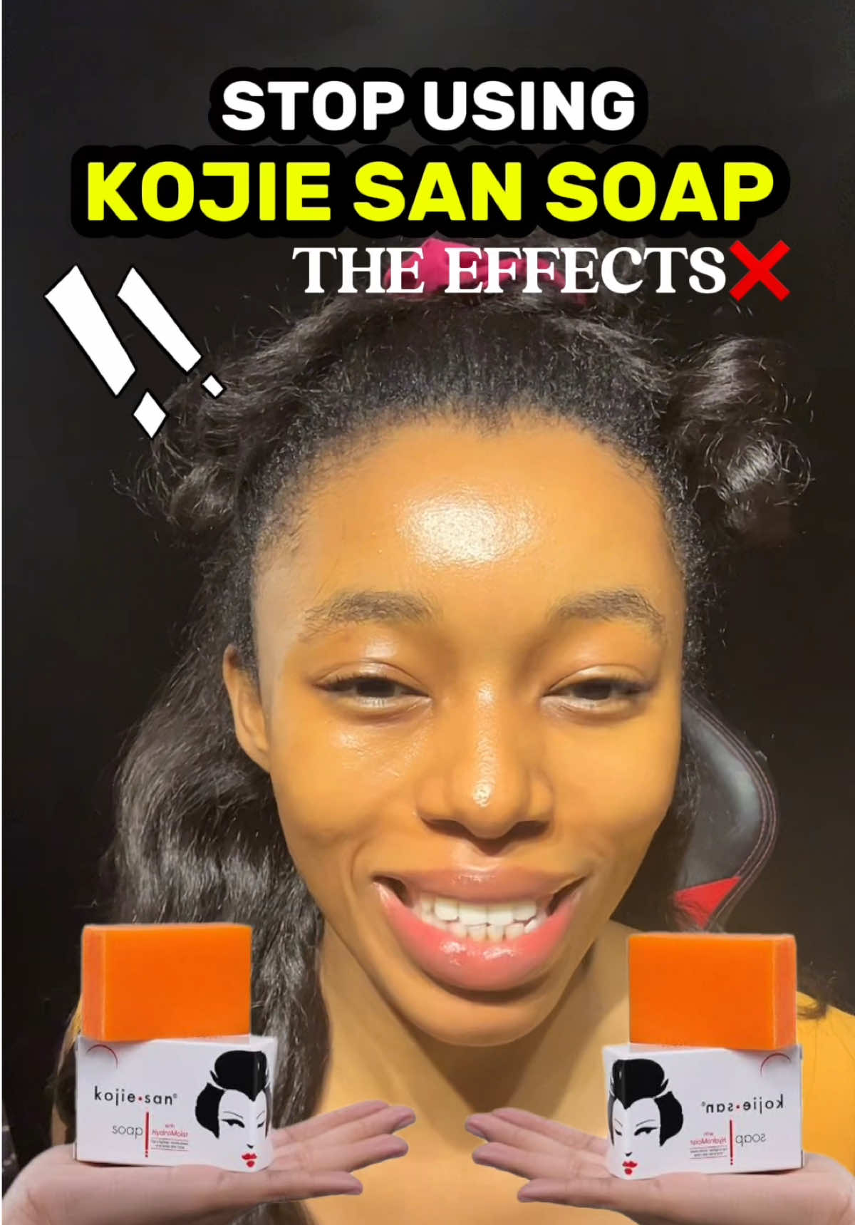 KOJIE SAN SOAP: My Honest Review on How I used Kojie San to brighten up my skin and treat my hyperpigmentation. #creatorsearchinsights #skincare #skincareroutines #kojiesan #kojiesansoap #GlowUp #whitening #whiteningsoap #transformation #beautytips #skincaretips #fypp #hyperpigmentation 