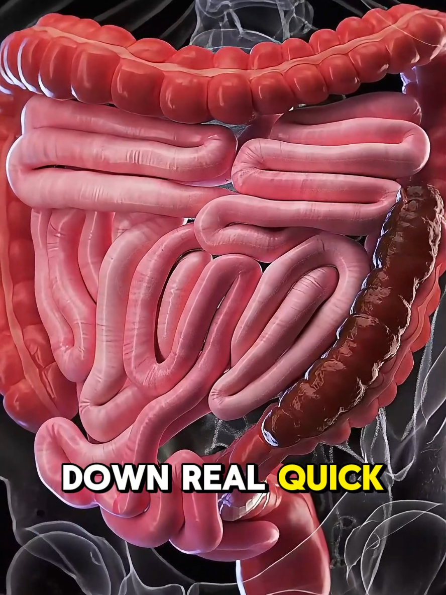 Whats  Happens In Your Body During Constipation (3D Animation) #happens #body #constipation #constipationrelief #constipated #colon #muscle #crampy #gut #medical3danimation #3dmedicalanimation 