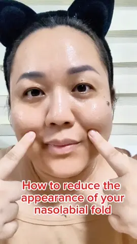 The best thing a person could wear is his or her smile. However, as we age, our smile lines or nasolabial folds become more prominent. While this is something inevitable, we can do something about it. Try this  at-home hack in reducing smile lines. I use this @ksecret_global  Seoul 1988 Eye Cream. It helps reducing smile lines with consistent use. #GlowUpWithRetinalChallenge #KSECRET #Seoul1988