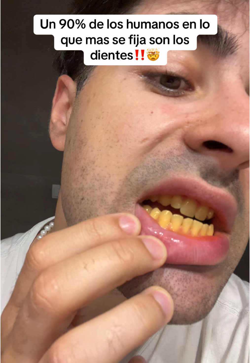 Si tienes los dientes amarillos por que fumas o por el cafe. Esto te puede venir bien 🥶#teethwhitening #whitening #teethcare #teethtok 