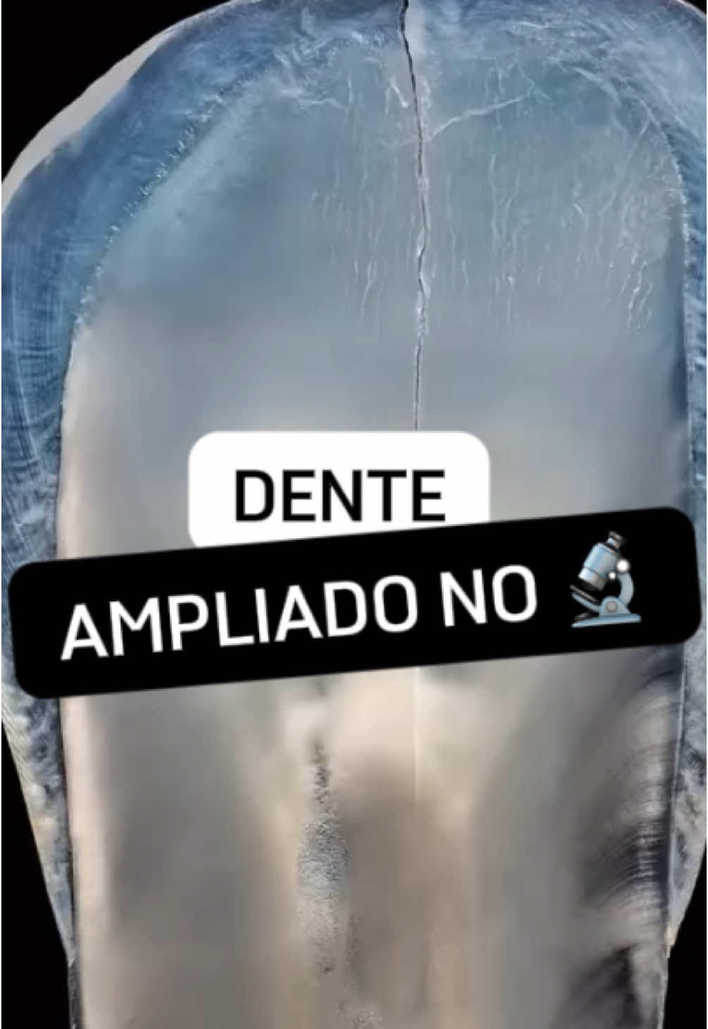 Ampliando um dente no microscópio eletrônico 🦷 #microscopio #microbiologia #biologia 