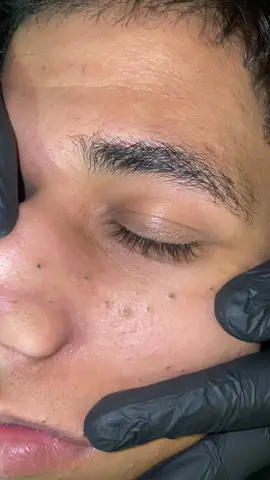 Full video (17min)link in bio ❤️  #trend_barbershop #تنضيف_بشرة #skincare #رؤوس_سوداء @Mahmoudgamaltrend 