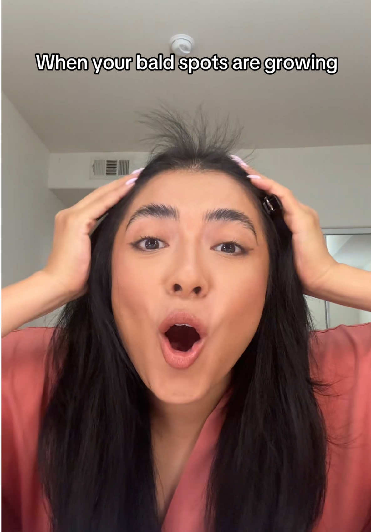 How do I keep it down?! #hairloss #hairtok #baldspot #hairregrowth 