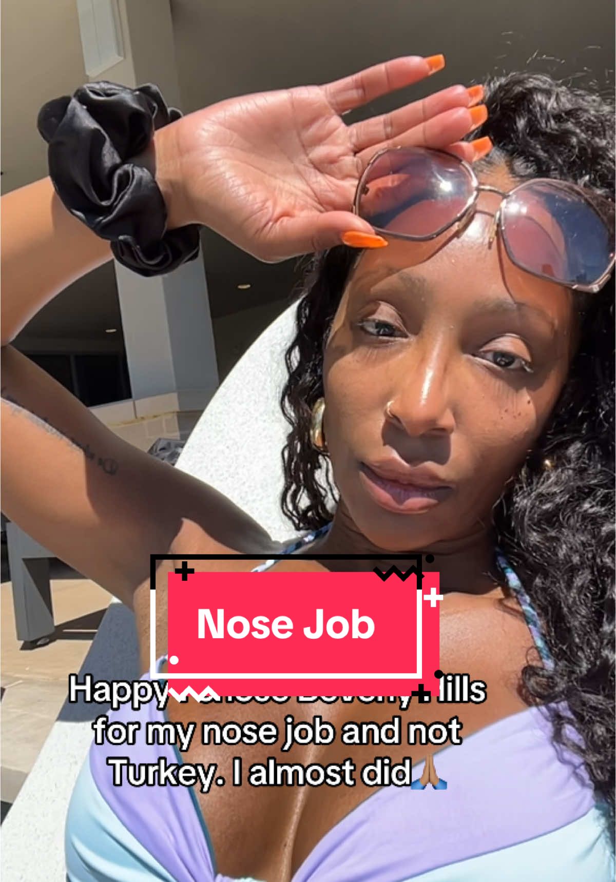 He kept it natural and as close to my natural nose as possible🙏🏽 It fits my face and is symmetrically balanced💕 #nosejob #plasticsurgery #barbienose #rhinoplasty 