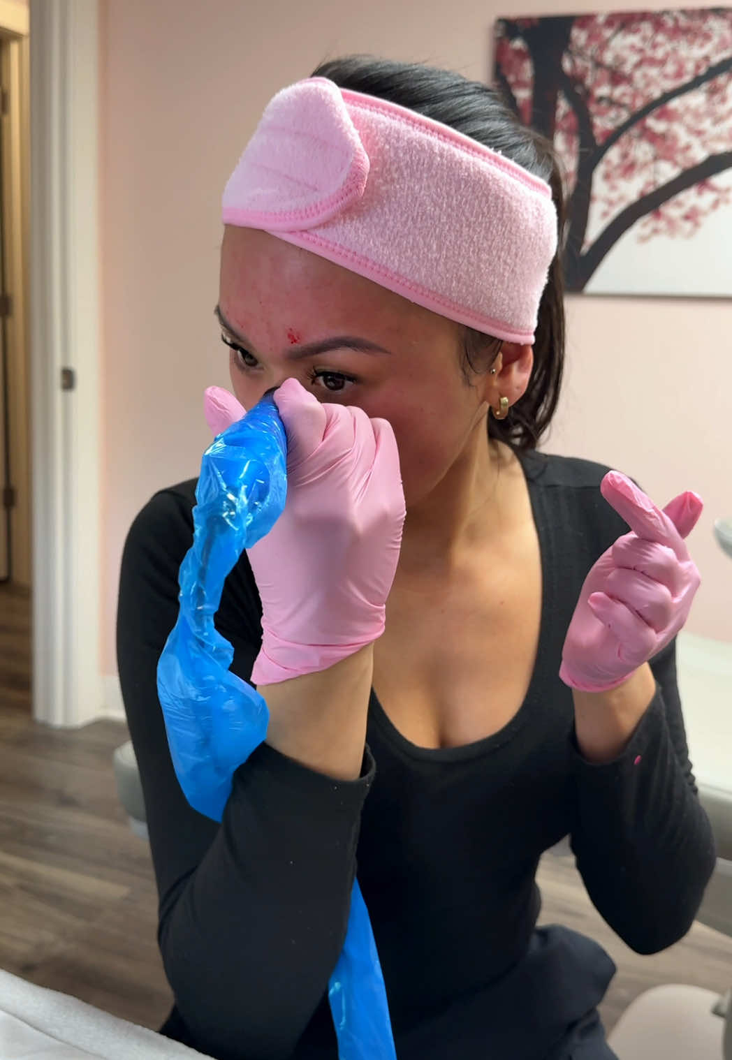 Microneedling asmr 💁🏻‍♀️