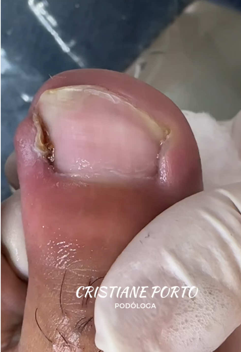 🤤| VÍDEO SATISFATÓRIO (HORA DE DORMIR)  . #podologia #unhas #satisfying #satisfatório #nails 