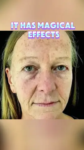 Micro-Lift Effect Neck Energizer #tiktok #tiktokshop #youthfulneck #zseaskincare #neckfirmingcream  #neck #neckcream #ZSEAneckcream #beauty#TiktokShopMemorialDay