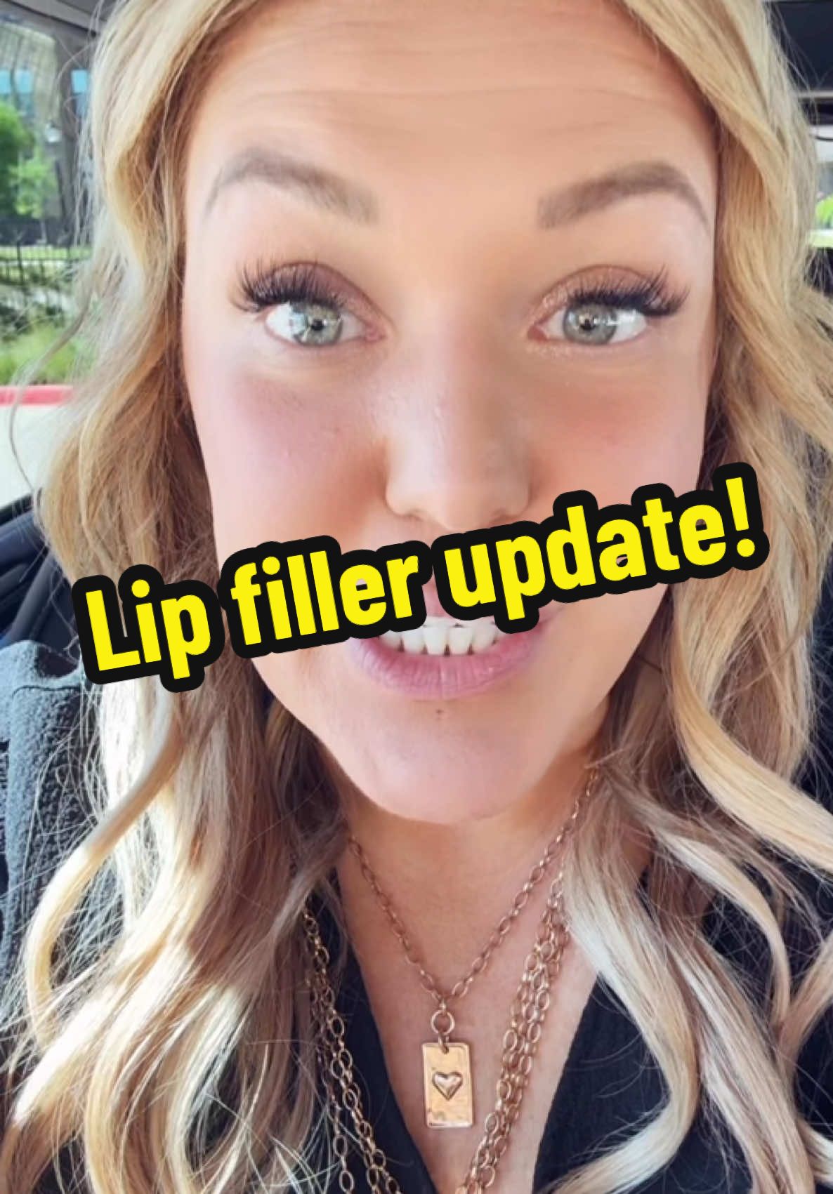 Lip filler update! #lipfiller #injector #lips #babydolllips #filler #dissolve #newlips #obsessed #plump #kissablelips #kiss #texas #dfw #dallas #frisco #lemmonavenue 